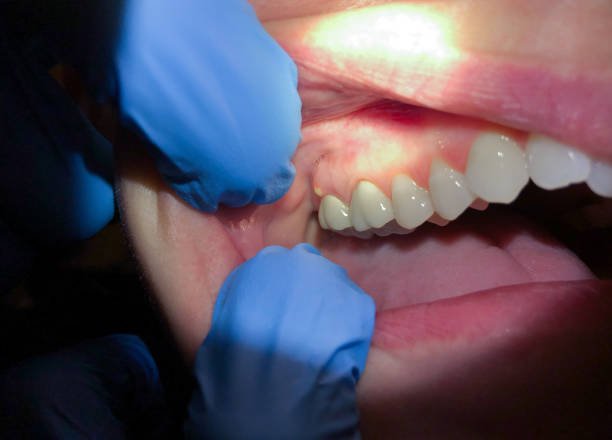 Best Emergency Treatment for Jaw Pain or Injury in Osage City, KS